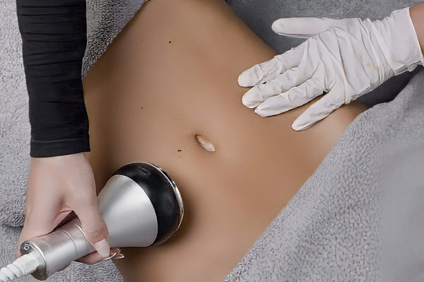 La lipocavitation